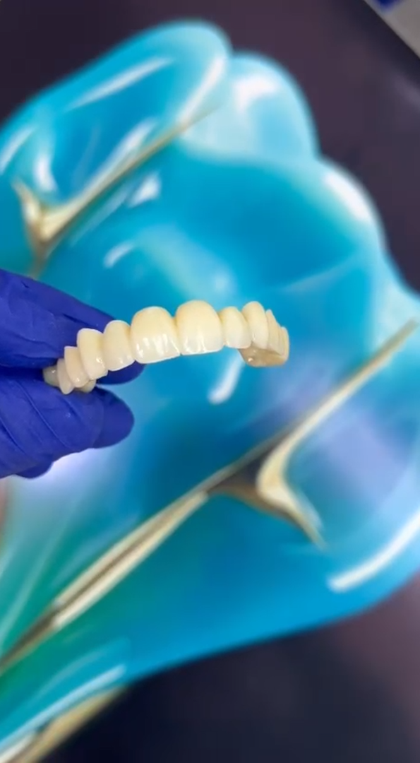 Still 2026-04-20 184314_1.3.1